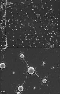 Nanoscale Tungsten-Microbial Interface of the Metal Immobilizing Thermoacidophilic Archaeon Metallosphaera sedula Cultivated With Tungsten Polyoxometalate